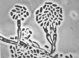 sefalosporin nedir